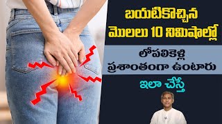 Home Remedies for Piles  Get Rid of Hemorrhoids  Pain Relief  Manthenas Health Tips [upl. by Meggs]