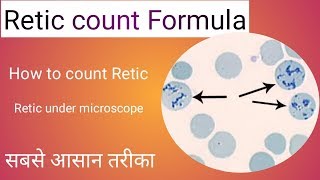 Retic count formula [upl. by Assenna]