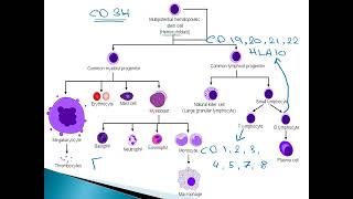 Acute Lymphocytic Leukemia ALL in pediatrics [upl. by Hidie436]