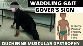 Duchenne Muscular dystrophy Govers sign Waddling gait [upl. by Denney]