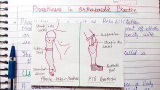 Prosthesis in Orthopaedic Practice  uses parts of prosthesis [upl. by Suinotna]