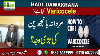 Varicocele Symptoms and Treatment  Varicocele Treatment Without Surgery  Testicle Pain ka ilaj [upl. by Ennaerb834]