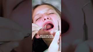 How to Spot Cavities in Kids [upl. by Susette]