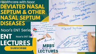 deviated nasal septum  disorders of nasal septum  nasal septum diseases  DrNajeebLecturesJr [upl. by Gerdy]