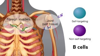 Chronic bacterial infection activates autoreactive B cells [upl. by Ellecrad684]