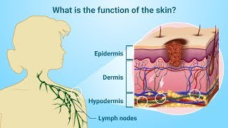 Understanding Melanoma [upl. by Nevar]