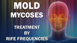 Mold and Mycoses Fungus Diseases  RIFE Frequencies Treatment  Energy amp Quantum Medicine [upl. by Pinkham]