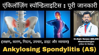 एंकिलॉज़िंग स्पॉन्डिलाइटिस  पूरी जानकारी  All about Ankylosing Spondylitis  HLAB27 Arthritis [upl. by Iroj]