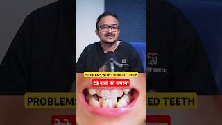 Crooked teeth can be much bad suratdentist dentist smiledentist [upl. by Ahsaenat]