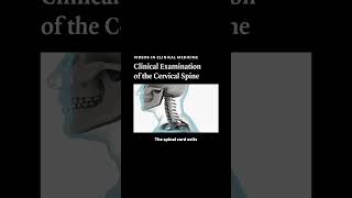 Clinical Examination of the Cervical Spine  NEJM [upl. by Eladnyl]