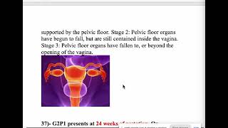 FCPS FEB 2024 DR RASHEEDA RECALLS CONINUATION Q36 45 [upl. by Ttessil]