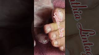 full video pedicure with ingrown removal [upl. by Enalda304]