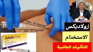 ابرة زولادكس zoladex  الجرعة والاستخدام والاعراض الجانبية [upl. by Morentz]