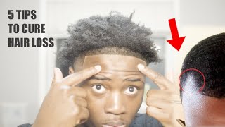 How To Naturally Cure Hairloss  a Receding hairline  and Thinning in 30 days [upl. by Shulman]