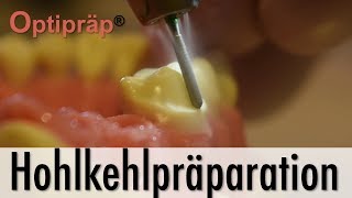 Tutorial Hohlkehlpräparation mit Optipräp® [upl. by Ahsot]