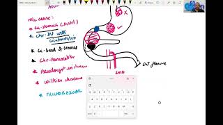 Gastric Outlet Obstruction Clinical Approach for Final MBBS students [upl. by Beauchamp446]