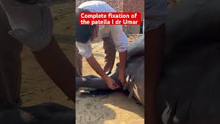 Complete fixation of the patella l dr Umar khan [upl. by Bern67]