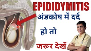 Epididymitis SymptomsCauses And Treatment Homeopathic Medicine Testicular Pain DrRamdeo Lamoria [upl. by Aneerbas515]