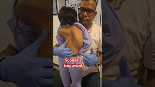 Scoliosis treatment drrajneeshkant [upl. by Uba]