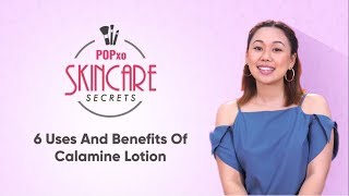 6 Uses And Benefits Of Calamine Lotion  POPxo Skincare Secrets [upl. by Marcel156]