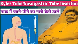 ryles tube insertion nasogastric tube insertion hindi technique NG Tube RT Insertion Dr Satish [upl. by Eiralav239]