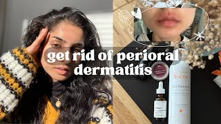 my perioral dermatitis journey  what actually worked what didnt natural healing and more [upl. by Tullius648]