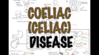 Coeliac Celiac Disease  Overview signs and symptoms pathophysiology diagnosis treatment [upl. by Irwinn]