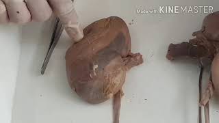 Anatomy of kidney by Dr Meetu Agarwal [upl. by Antons774]