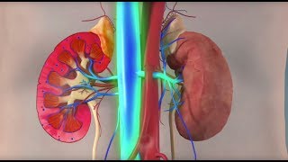 Rhabdomyolysis  Mayo Clinic [upl. by Amehsat549]