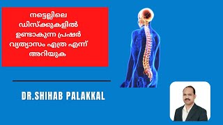 INTRADISCAL PRESSURE [upl. by Arries]