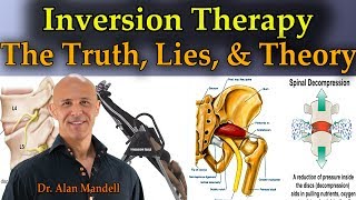 Inversion Therapy The Truth Lies and Theory  Dr Mandell [upl. by Aubrie893]