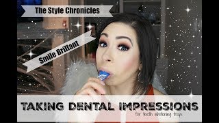 Taking Dental Impressions for Teeth Whitening Trays  Smile Brilliant [upl. by Mahoney]