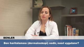 Ben haritalaması dermatoskopi nedir nasıl uygulanır [upl. by Edrick]