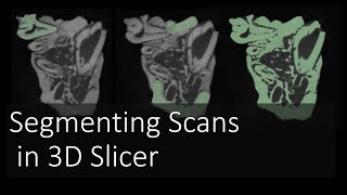 Segmenting Scans in 3D Slicer  Introduction to Digital Preparation Video 11 [upl. by Knipe693]