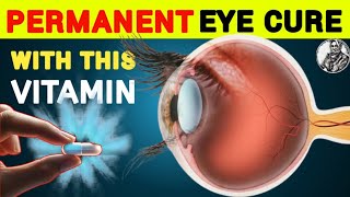 1 Vitamin to Cure Eye Problem Permanently  Eye care Tips  Vitamins eyecare [upl. by Tamra930]