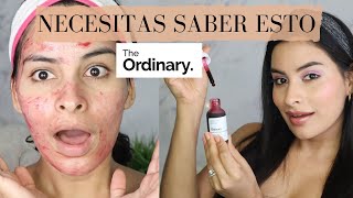 NECESITAS SABER ESTO SI VAS A USAR THE ORDINARY PEELING SOLUTION POR PRIMERA VEZ [upl. by Redwine]