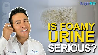 Top 5 Reasons Of Foamy or Bubbly Urine One Is Kidney Disease [upl. by Doroteya192]