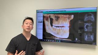 IV Sedation vs Oral Sedation [upl. by Hsizan]