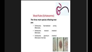 Parasitology  Schistosoma haematobium  by Dr Shimaa Nephrology Module [upl. by Ruscio12]