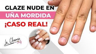 CASO REAL ¿Cómo hacer uñas en una persona con ONICOFAGIA Coloca el molde en 3 distintas maneras [upl. by Sherrard]