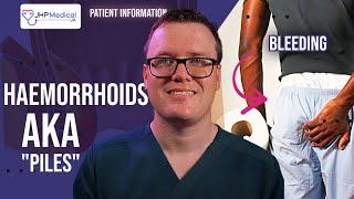 DOCTOR Explains HAEMORRHOIDS PILES  Symptoms Causes and Treatment  HEMORRHOIDS USA [upl. by Ellevel]