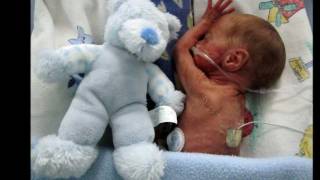 24 Week Preemie  Christiaan Brink Jou eerste jaar  Your first year [upl. by Vaasta101]