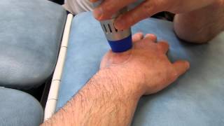 Hand Treatment 6th session Zimmer enPuls narrated by the patient [upl. by Dorreg436]