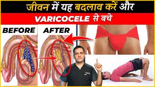 10 Lifestyle changes to stop growing varicocele  Dr Gaurav Gangwani Interventional Radiologist [upl. by Fishman]