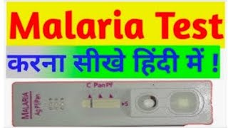 Malaria Rapid card test kaise hota hai मलेरिया का टेस्ट कैसे होता है full explain in hindi [upl. by Nesnej]