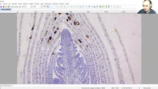 Meristemo apical del tallo de Elodea sp con el microscopio óptico [upl. by Parik]