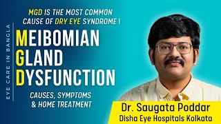 Meibomian Gland Dysfunction Causes Symptoms and remedy for dry eyes MGD by Dr Saugata Poddar [upl. by Htenay271]