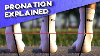 What is overpronation  Pronation types explained [upl. by Ardnuaek49]