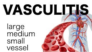 Vasculitis [upl. by Obie]