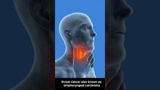 Throat Cancer Symptoms short throatcancer laryngealcancer [upl. by Saile]